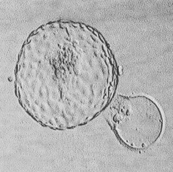 blastocyst